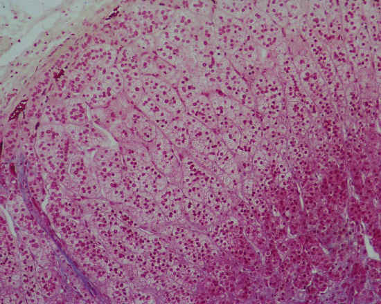 Ghiandola endocrina cordonale - surrene - 10x